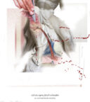 Ins eigene Bein schneiden